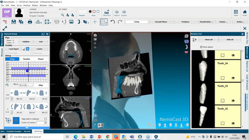 Software de planejamento pré-operatório - NemoFab Ortho - Nemotec - médico-hospitalar / clínico / odontológico