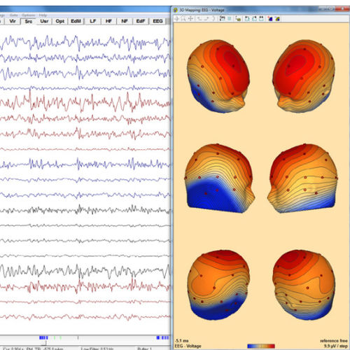 Software de análise - Research 7.1 - BESA GmbH - de visualização 3D / de diagnóstico / de importação