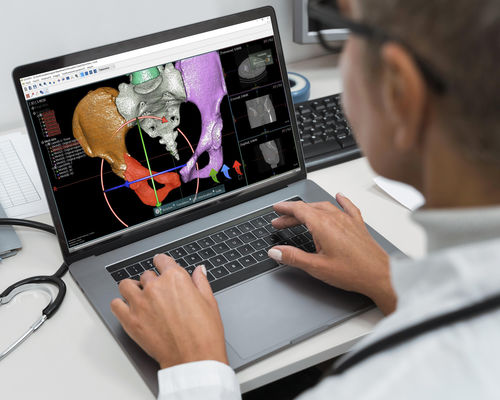 Software de planejamento pré-operatório - OOOPDS - Taiwan Main Orthopaedic Biotechnology - de visualização / de simulação / de impressão 3D