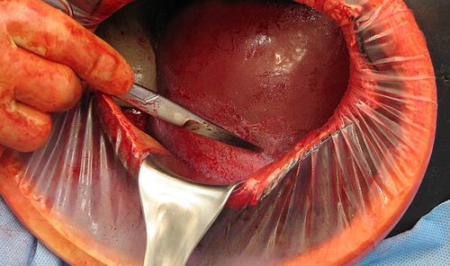 Simulador de paciente de parto - C-Celia C-SECTION - Operative Experience Inc. - para procedimentos de emergência médica / de cirurgia / obstétrico-ginecológico
