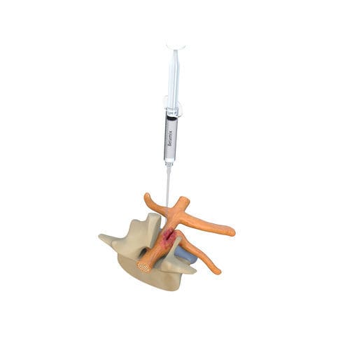 Barreira antiaderências em gel - BETAMIX - Betatech Medical - para laparotomia abdominal / para laparoscopia / para cesarianas
