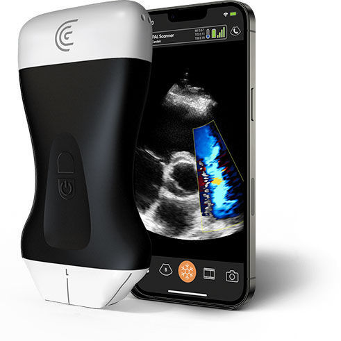 Aparelho de ultrassom de bolso - PAL - Clarius Mobile Health - geral / com Doppler colorido / em preto e branco