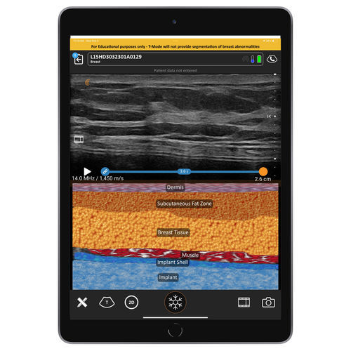 Software para ecografia - T-Mode  - Clarius Mobile Health - de visualização / médico-hospitalar