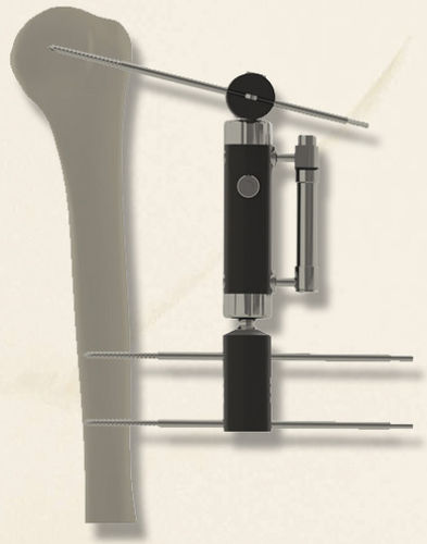 Fixador externo para úmero - 40140030101 - Biotech Medical - tubular