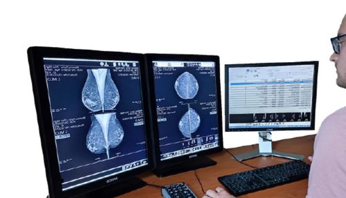 Software de diagnóstico - MED MAMMO - Medecom - médico-hospitalar / para PACS / para mamografia