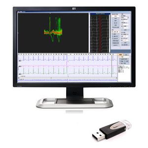 Software de criação de laudos - iTengo+  - BORSAM Biomedical Instrument - de análise / para ECG / para hospital