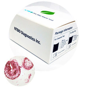 Teste rápido de FOB - N040 series - NTBIO Diagnostics - para câncer / para oncologia / de marcadores tumorais