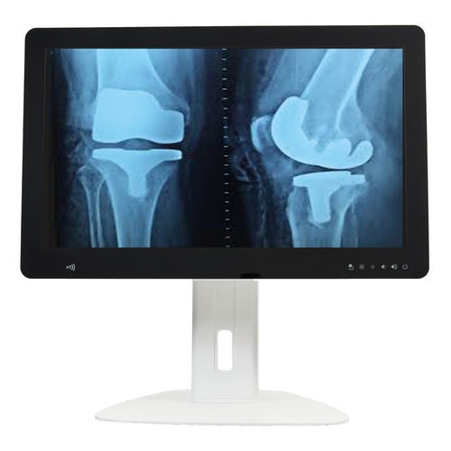 Thin client Quad-Core - SCREEN MEDICAL - IMPACT technologies - Intel® Core i3 / para carrinho de computador / multifunções