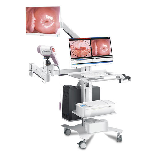Videocolposcópio - KN-2200I HD  - Kernel Medical Equipment Co., Ltd - com carrinho