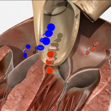 Módulo de simulação para ecocardiografia - SIMTICS - de anatomia / para valvuloplastia / baseado em tecnologia Web