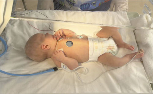 Módulo de simulação para ecografia - SIMTICS - de anatomia / para procedimentos pediátricos / infantil