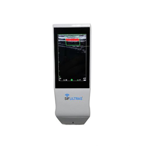 Aparelho de ultrassom de bolso - SIFULTRAS-5.14 - SIFSOF - para emergência médica / em preto e branco / com Doppler colorido