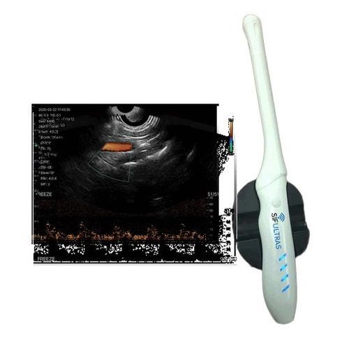 Aparelho de ultrassom portátil - SIFULTRAS-6.36 - SIFSOF - endovaginal / com Doppler colorido / em preto e branco