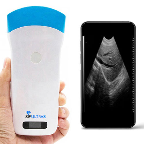Aparelho de ultrassom de bolso - SIFULTRAS-5.2 - SIFSOF - ginecológico e obstétrico / abdominal e pélvico / para emergência médica