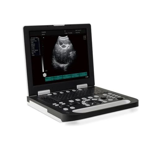 Aparelho de ultrassom portátil - DP-50 Plus - Promed Technology - geral / ginecológico e obstétrico / abdominal e pélvico