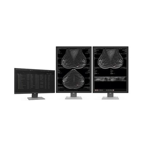 Software de análise - MammoScape™ - VAREX Imaging - de visualização / de diagnóstico / de detecção