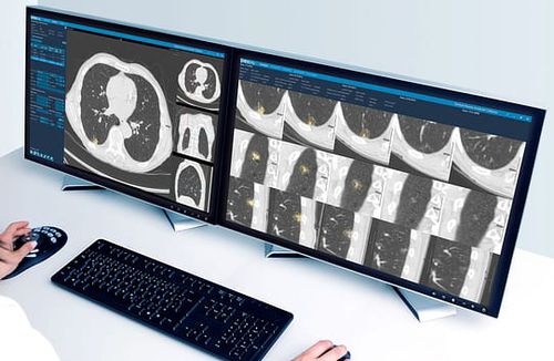 Software de análise de imagens - Veolity - VAREX Imaging - de gestão / de criação de laudos / CAD