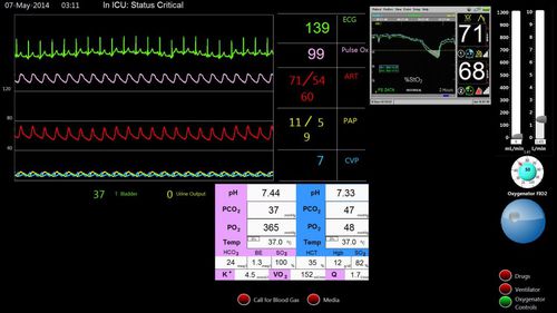 Simulador de paciente de ECMO - Biomed Simulation Inc. - para procedimentos cardiopulmonares / tela / assistido por computador