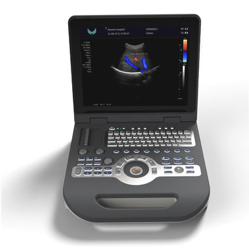 Aparelho De Ultrassom Portátil - XF3500 - Xianfeng Ultrasound Medical ...