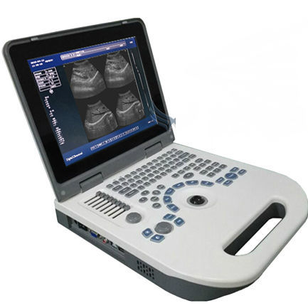 Aparelho de ultrassom portátil - XF30A(XF50)  - Xianfeng Ultrasound Medical - geral / em preto e branco / convexo