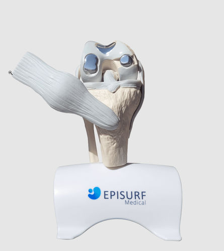 Implante de joelho - Episurf Medical - anatômico / de cobalto-cromo