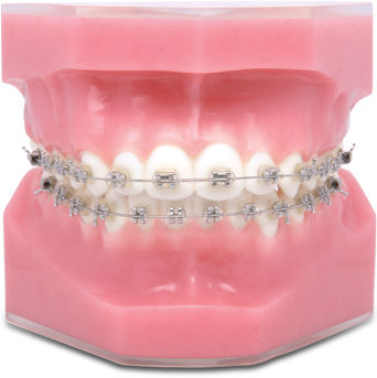 Fio ortodôntico em níquel-titânio - TP Orthodontics - em aço inoxidável / em titânio
