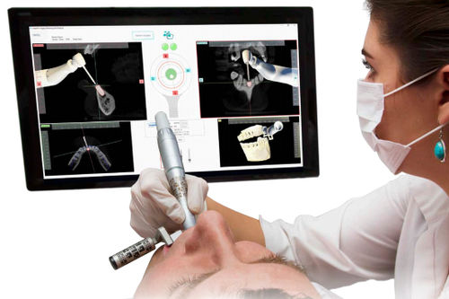Sistema de navegação cirúrgica para cirurgia odontológica - Inliant Dental Technologies Inc. - óptico