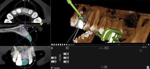 Software de planejamento - X-Guide - X-Nav Technologies - de importação / de navegação / de anatomia
