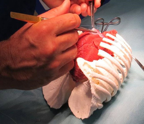 Simulador para cirurgia cardíaca - 3D Lifeprints UK Ltd - para cirurgia robótica