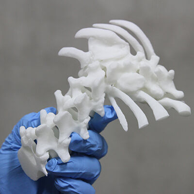 Modelo de raquis - 3D Lifeprints UK Ltd - para escoliose