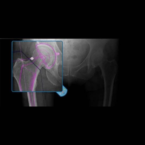 Software médico-hospitalar - OrthoView - Materialise UK - de análise / de gestão / de planejamento