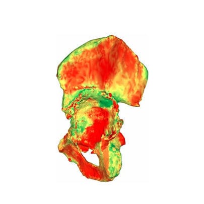Software médico-hospitalar - aMace - Materialise UK - clínico / para TC / para cirurgia