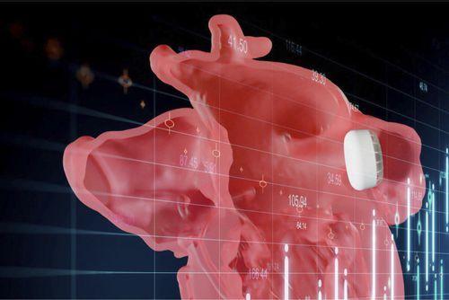 Software visualizador - Enlight LAAO - Materialise UK - de planejamento / de compartilhamento / de impressão 3D