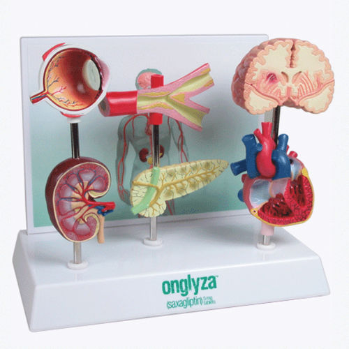 Modelo anatômico para diabetes - A575 - Apple Biomedical - de coração / de artéria / de olho