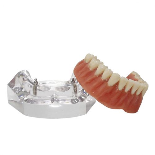 Modelo anatômico de dentição - 9566  - Nacional Ossos - para implantodontia / para prótese dentária / para ensino