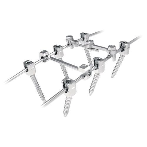 Sistema de osteossíntese toracolombar - Silver  - NORMMED Medical Devices - via posterior
