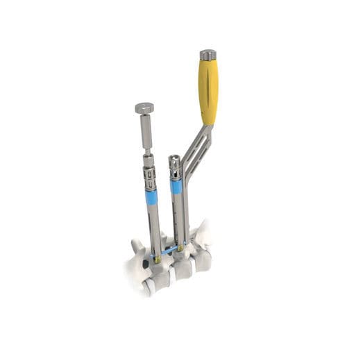 Sistema de posicionamento de parafusos pediculares minimamente invasivo - ARES  - NORMMED Medical Devices