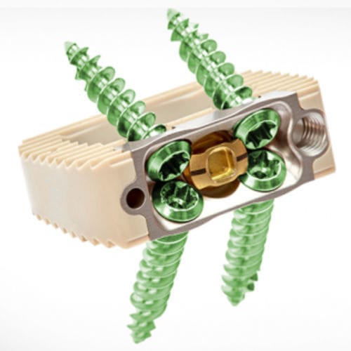 Espaçador intervertebral lombar - Spineology - via anterior / em PEEK