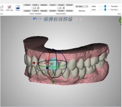 Software ortodôntico - PLAN - VERSION 5.0 - Orchestrate Orthodontic Technologies - de controle / de design / Windows