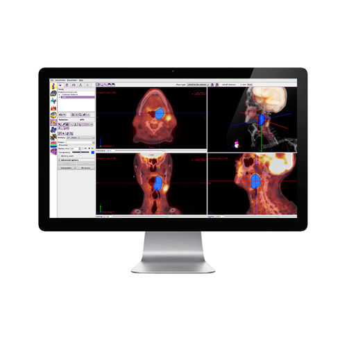 Software de detecção de bordas - IMAgo - DOSIsoft - para radioterapia