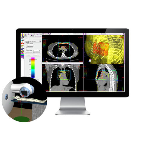 Software de simulação - SIMAgo - DOSIsoft - para radioterapia