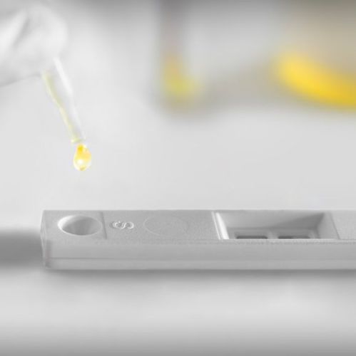 Teste rápido de câncer da bexiga - UBC® - IDL Biotech - para oncologia / de marcadores tumorais / de urina