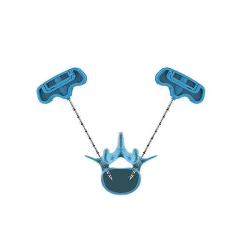 Dispositivo para reparação de fraturas vertebrais de agulha - PVP - Hicren Zhejiang Medtech - para vertebroplastia percutânea