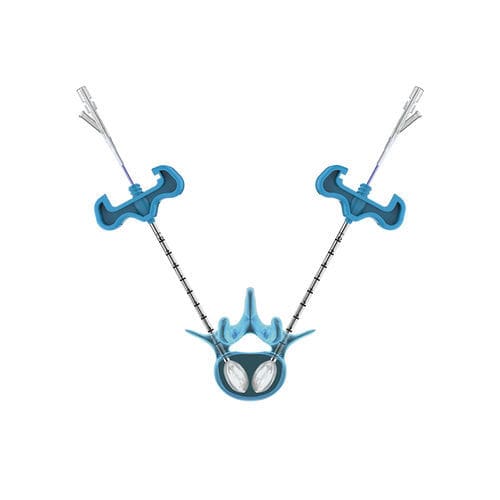 Dispositivo para reparação de fraturas vertebrais com balão - PKP - Hicren Zhejiang Medtech - para cifoplastia percutânea