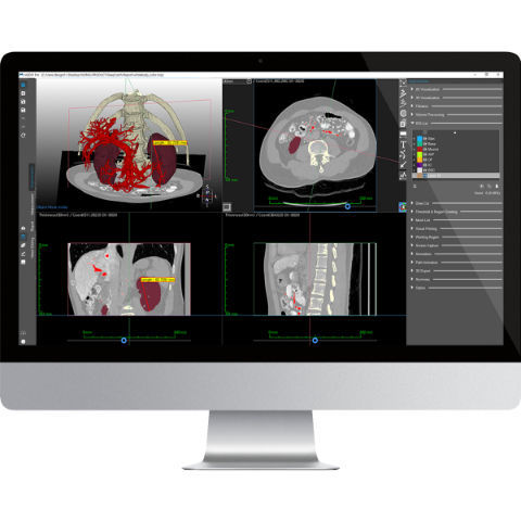 Software de análise - Medip - MEDICALIP Co., Ltd. - de medição / de impressão 3D / de modelagem