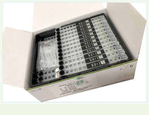 Kit de teste para doenças cardiovasculares - 0007HC - Beijing O&D Biotech Co., Ltd. - de creatina quinase / de soro / de imunoquimioluminescência