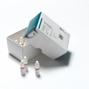 Kit de reagentes de soro - 36158 - SSI Diagnostica - antissoro / anticorpos / de serologia