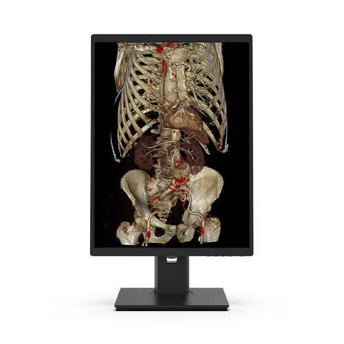 Monitor médico - 21X3C-I3 - KTC Medical Solutions - de diagnóstico / para radiologia / 21,3"