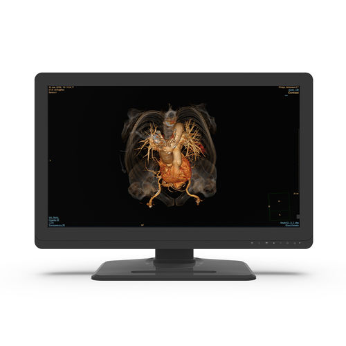 Monitor médico - 27X4C-I0 - KTC Medical Solutions - de diagnóstico / para radiologia / QHD
