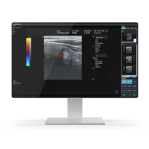 Computador médico Intel® Core i7 - 24H32 - KTC Medical Solutions - para carrinho de computador / para estabelecimento de saúde / para exames de imagem